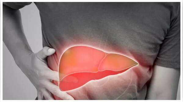 Apart from Sugar, 5 daily habits and foods that damage liver